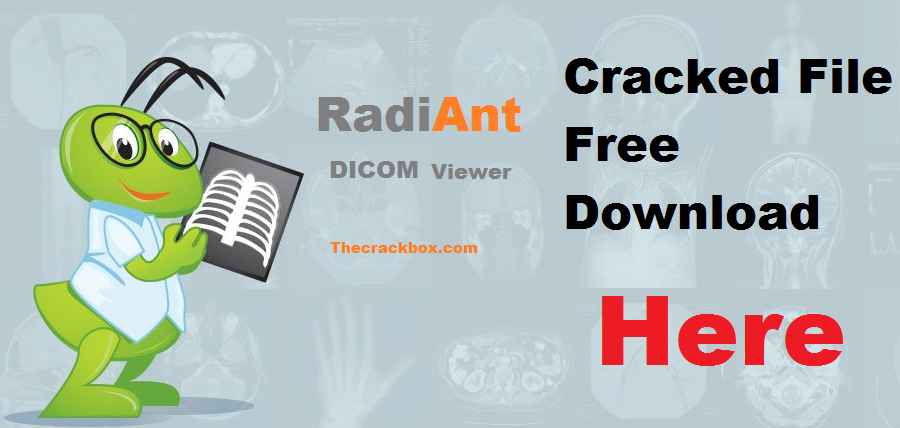 radiant dicom viewer license